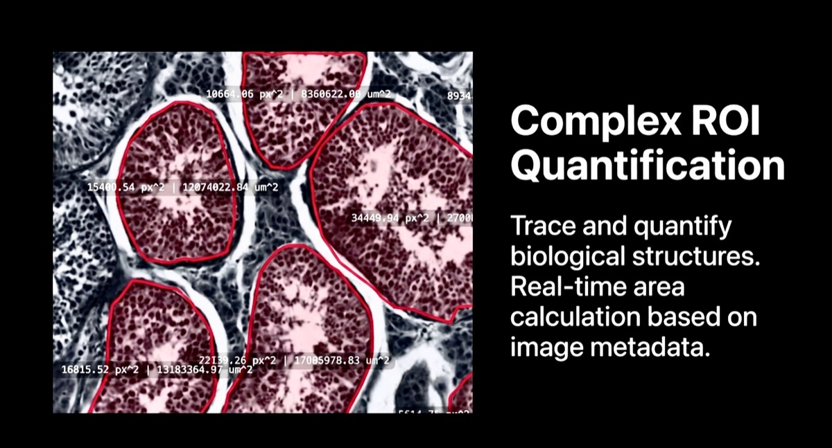 ROI quantification interface with area and count tools.